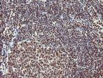 EXOSC7 Antibody in Immunohistochemistry (Paraffin) (IHC (P))