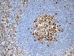 EZH2 Antibody in Immunohistochemistry (Paraffin) (IHC (P))