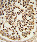 EZH2 Antibody in Immunohistochemistry (IHC)