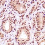 EZH2 Antibody in Immunohistochemistry (IHC)