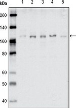 EphB1 Antibody in Western Blot (WB)