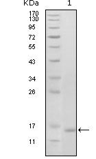 EphB6 Antibody in Western Blot (WB)