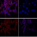 TM111 Antibody in Immunocytochemistry (ICC/IF)