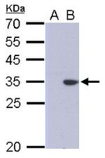 Hepatitis C Virus E1 Antibody in Western Blot (WB)