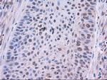 EpCAM Antibody in Immunohistochemistry (Paraffin) (IHC (P))