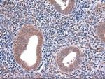 EpCAM Antibody in Immunohistochemistry (Paraffin) (IHC (P))