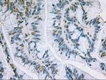 EpCAM Antibody in Immunohistochemistry (Paraffin) (IHC (P))