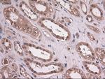 EpCAM Antibody in Immunohistochemistry (Paraffin) (IHC (P))