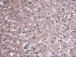 EpCAM Antibody in Immunohistochemistry (Paraffin) (IHC (P))