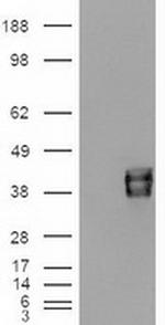 EpCAM Antibody in Western Blot (WB)