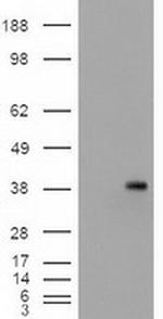 EpCAM Antibody in Western Blot (WB)