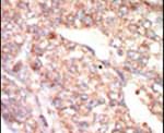 EphA1 Antibody in Immunohistochemistry (IHC)