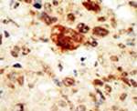 EphA1 Antibody in Immunohistochemistry (IHC)
