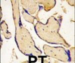 EphA3 Antibody in Immunohistochemistry (IHC)