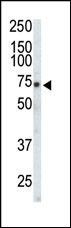 EphA3 Antibody in Western Blot (WB)