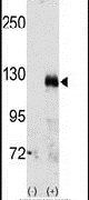 EphA3 Antibody in Western Blot (WB)