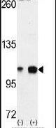 EphA4 Antibody in Western Blot (WB)