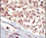 EphA5 Antibody in Immunohistochemistry (IHC)
