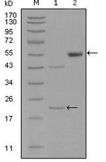 EphA5 Monoclonal Antibody (8B10B1,8B10F5)