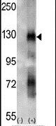 EphA6 Antibody in Western Blot (WB)