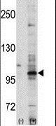 EphA7 Antibody in Western Blot (WB)