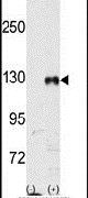 EphB1 Antibody in Western Blot (WB)