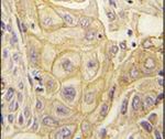 EphB2 Antibody in Immunohistochemistry (IHC)