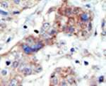 EphB3 Antibody in Immunohistochemistry (IHC)