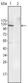 EphB4 Monoclonal Antibody (7H4A6)