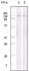 EphB6 Antibody in Western Blot (WB)
