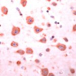 Ephrin A4 Antibody in Immunohistochemistry (IHC)