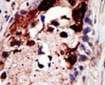 Epsin 2 Antibody in Immunohistochemistry (IHC)