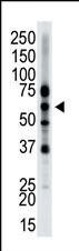 Epsin 2 Antibody in Western Blot (WB)