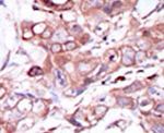 ErbB4 Antibody in Immunohistochemistry (IHC)
