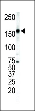 ErbB4 Antibody in Western Blot (WB)