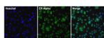 Estrogen Receptor alpha Monoclonal Antibody (33)