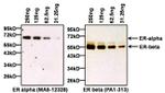 Estrogen Receptor alpha Antibody in Western Blot (WB)