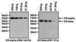 Estrogen Receptor alpha Antibody in Western Blot (WB)