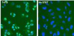 Estrogen Receptor alpha Antibody in Immunocytochemistry (ICC/IF)