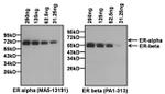 Estrogen Receptor alpha Antibody in Western Blot (WB)