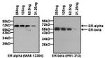 Estrogen Receptor alpha Antibody in Western Blot (WB)