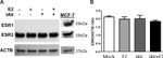 Estrogen Receptor beta Antibody in Western Blot (WB)