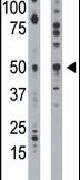 ETNK1 Antibody in Western Blot (WB)