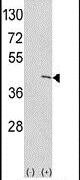 ETNK1 Antibody in Western Blot (WB)