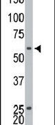 ETNK1 Antibody in Western Blot (WB)