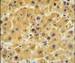 Factor X Antibody in Immunohistochemistry (IHC)