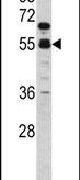 Factor X Antibody in Western Blot (WB)