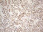 F12 Antibody in Immunohistochemistry (Paraffin) (IHC (P))