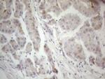 F12 Antibody in Immunohistochemistry (Paraffin) (IHC (P))