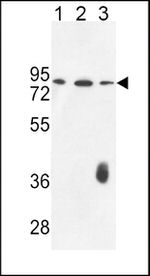 Factor XII Antibody in Western Blot (WB)
